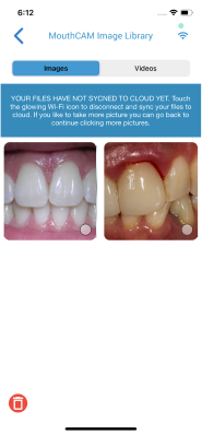 mouthcam instructions